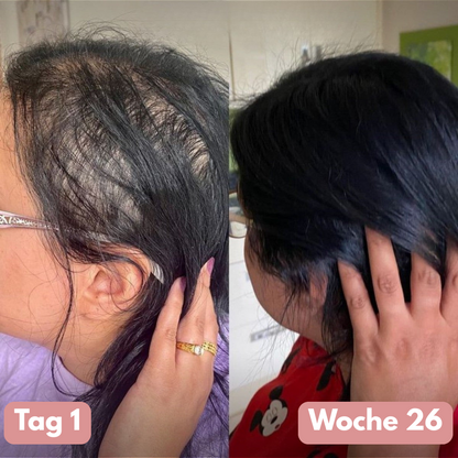 SIFIGUR™ Kürbiskernöl-Softgels