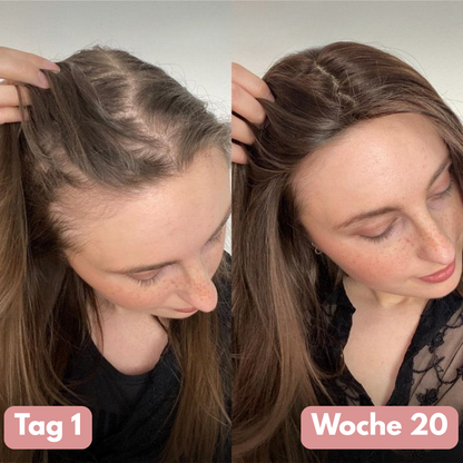 SIFIGUR™ Kürbiskernöl-Softgels